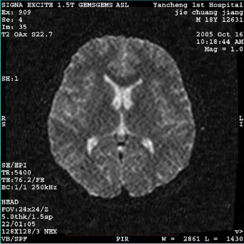 آرٹیفیکٹ WI/Fiesta Image White Pixel